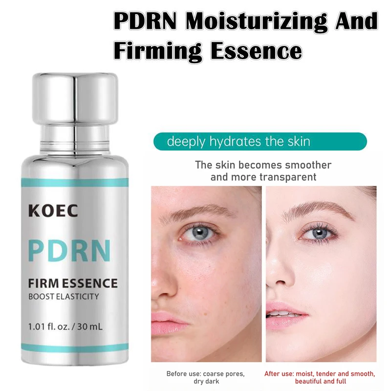 Pdrn Moisturizing And Firming Essence Boost Facial Elasticity Deep Hydration Intensive Nourishing Serum For Daily Skin Care