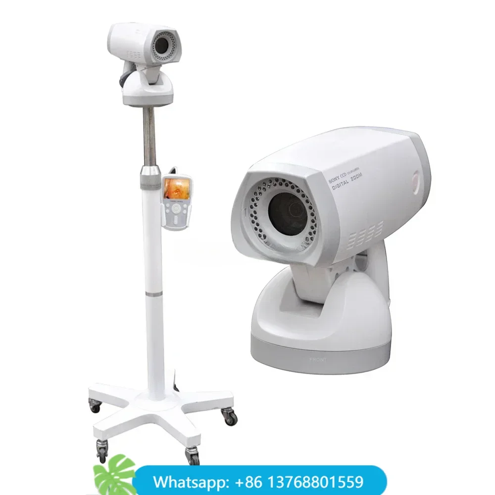 

Цифровое электронное видео для гинекологии LH9800A Colposcopy, Full Hd