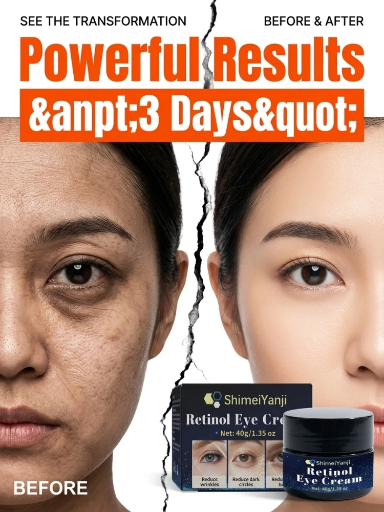 Hydrating Retinol Eye Care Cream, Smooth Skin Texture Around Eyes, Nourish Dry Eye Skin, Suitable for Daily Home Facial Skincare