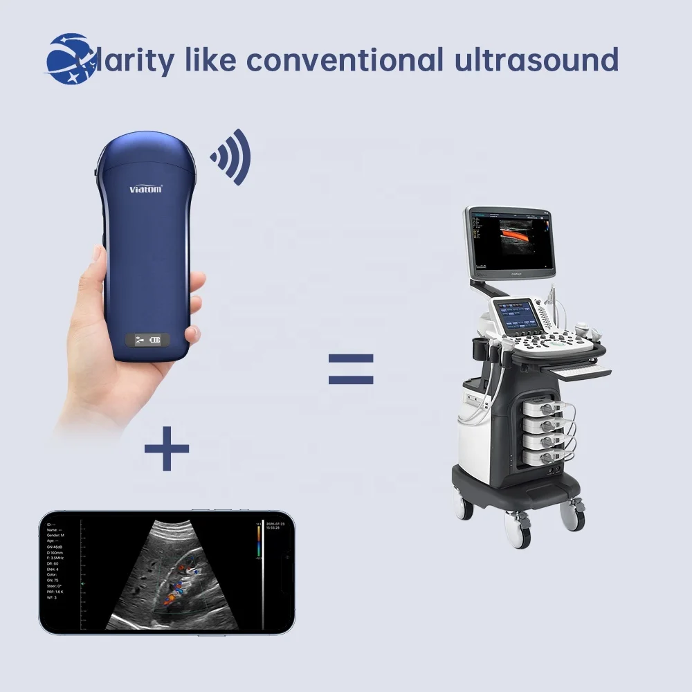 Viatom C10 Smartphone Ultrasound Price Wireless Charing Scanner Machine Linear/Convex/Cardiac 3-in 1 Probe Portable Ultrasound