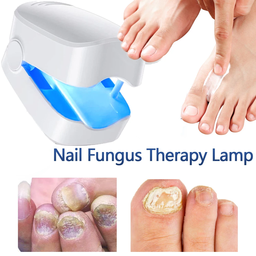 Nail Fungus Laser Treatment Device Repair Toenail Fingernail Fungus Treat Dermatomycosis Therapy Cure Machine Effectively Remove