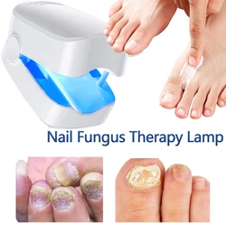 Dispositivo de tratamiento láser de hongos en las uñas, reparación de hongos en las uñas de los pies, TRATAMIENTO DE LA dermatomicosis, máquina de Cura, elimina eficazmente