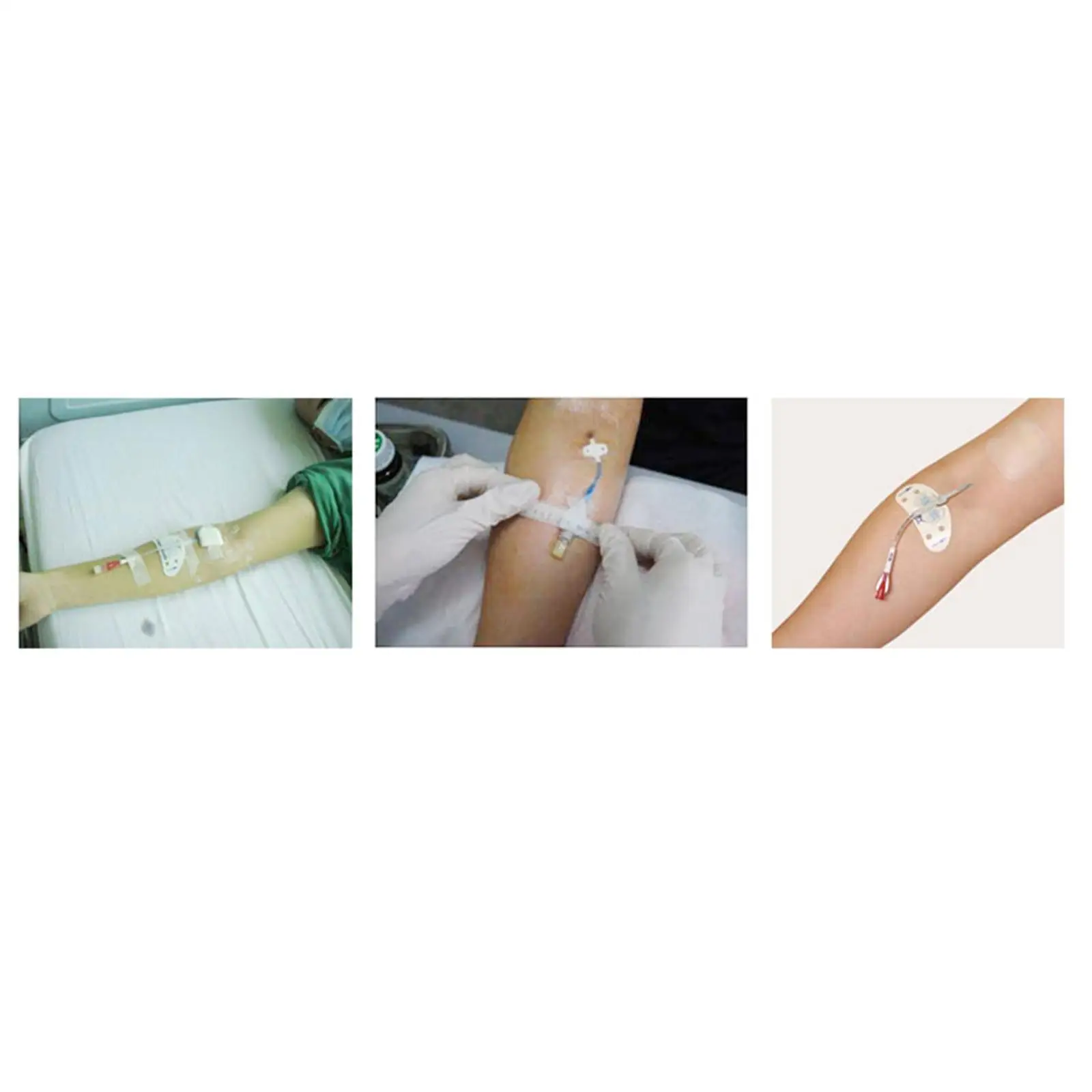 Line Shower Dressing Sleeve Cover, Watertight Arm Protector Nursing Protection IV Line Sleeve for Upper Arm Surgery