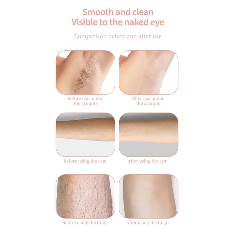 ماكينة حلاقة بيكيني برأس مزدوج A69T للنساء ماكينة حلاقة كهربائية رطبة وجافة غير مؤلمة ناعمة للنساء ماكينة تشذيب بيكيني وردي #4