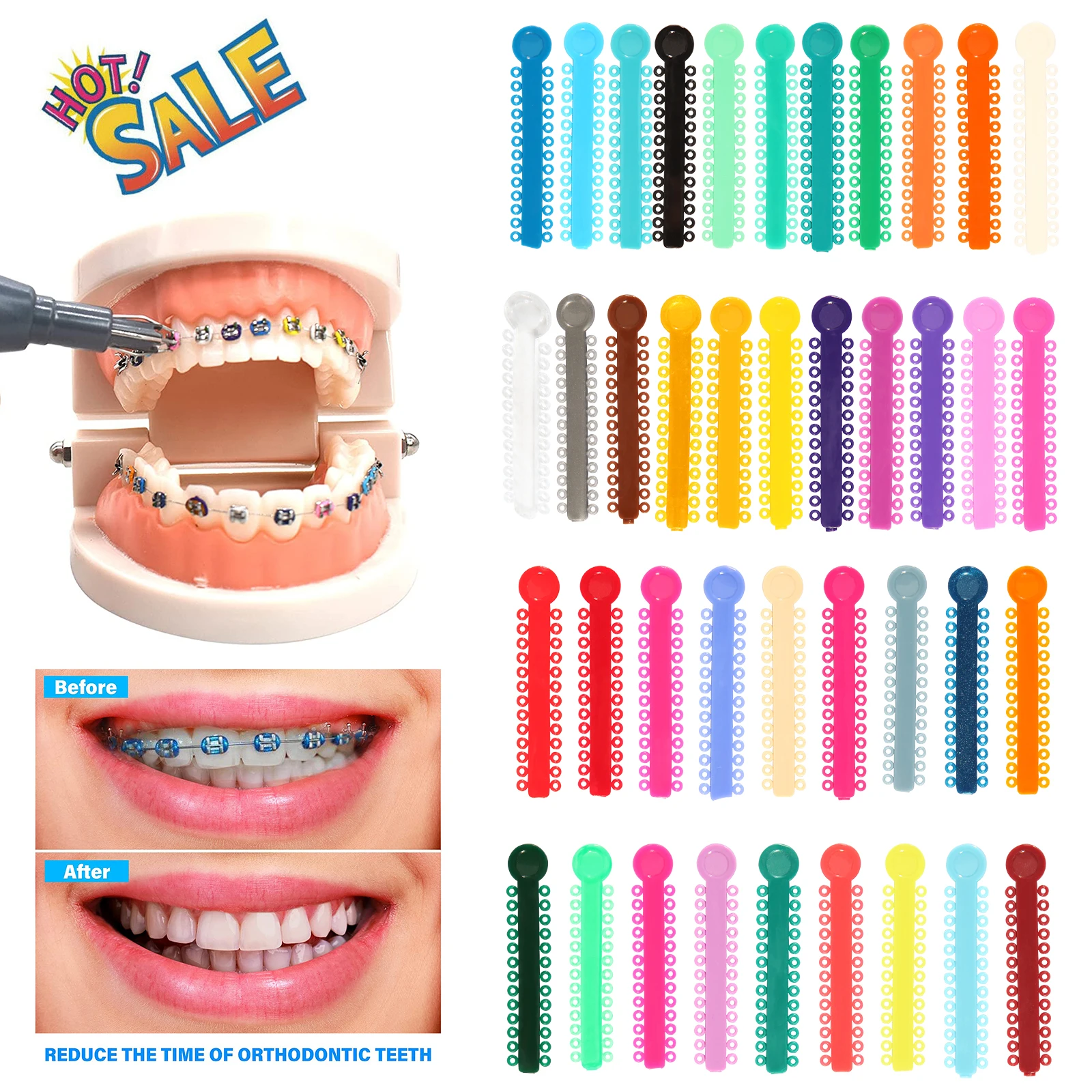 40Sticks / Pack Dental Orthodontic Elastic Ligature Ties for Brackets Braces 2.5*0.48 Colorful Dentist Orthodontics Treatment