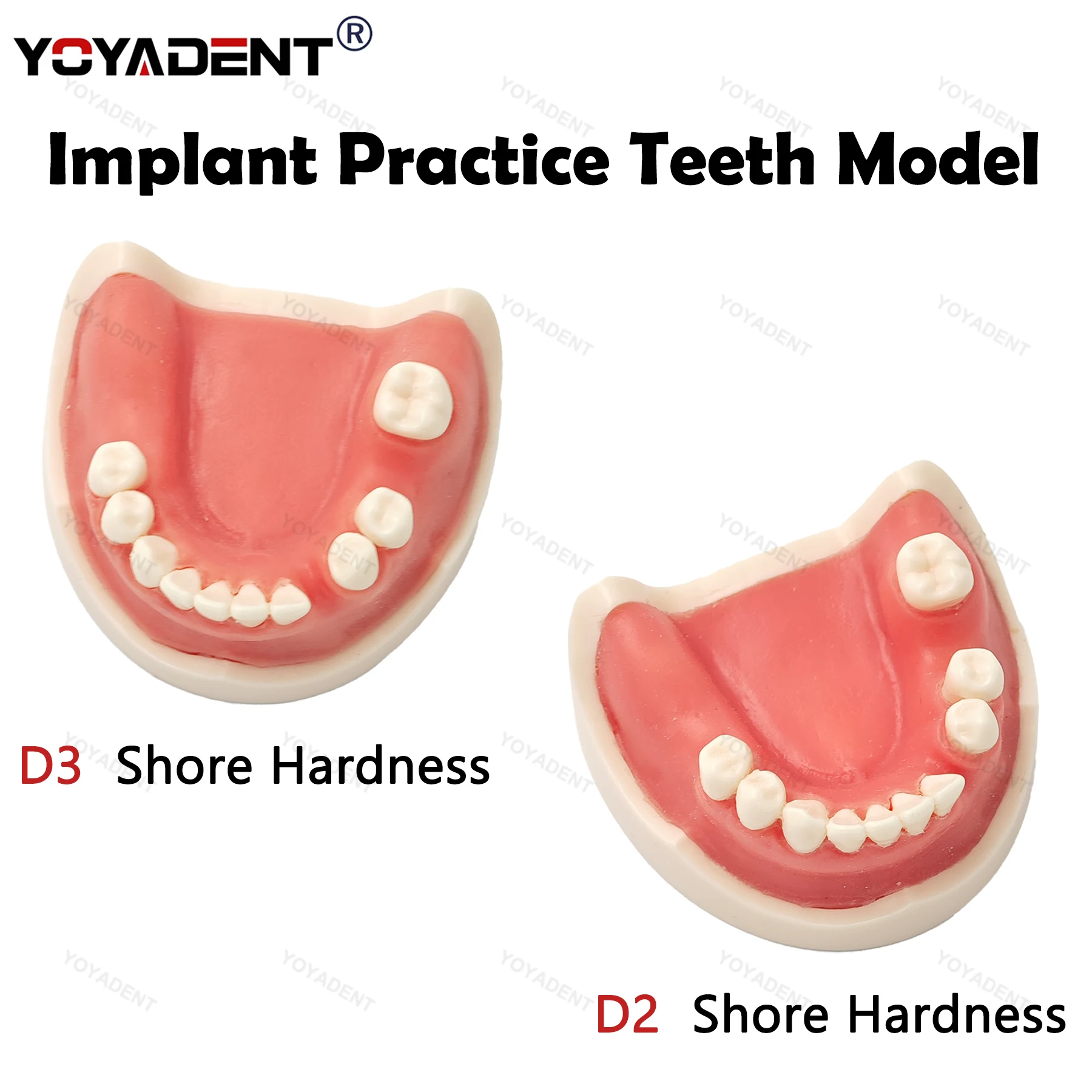 

Стоматологическая модель зубов с мягкими деснами, имплантат, образовательная практика, модель из смолы, модель для обучения студентов, измерительная твердость, стоматологические материалы