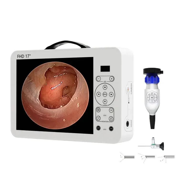 17 inch portable full hd laryngoscope price