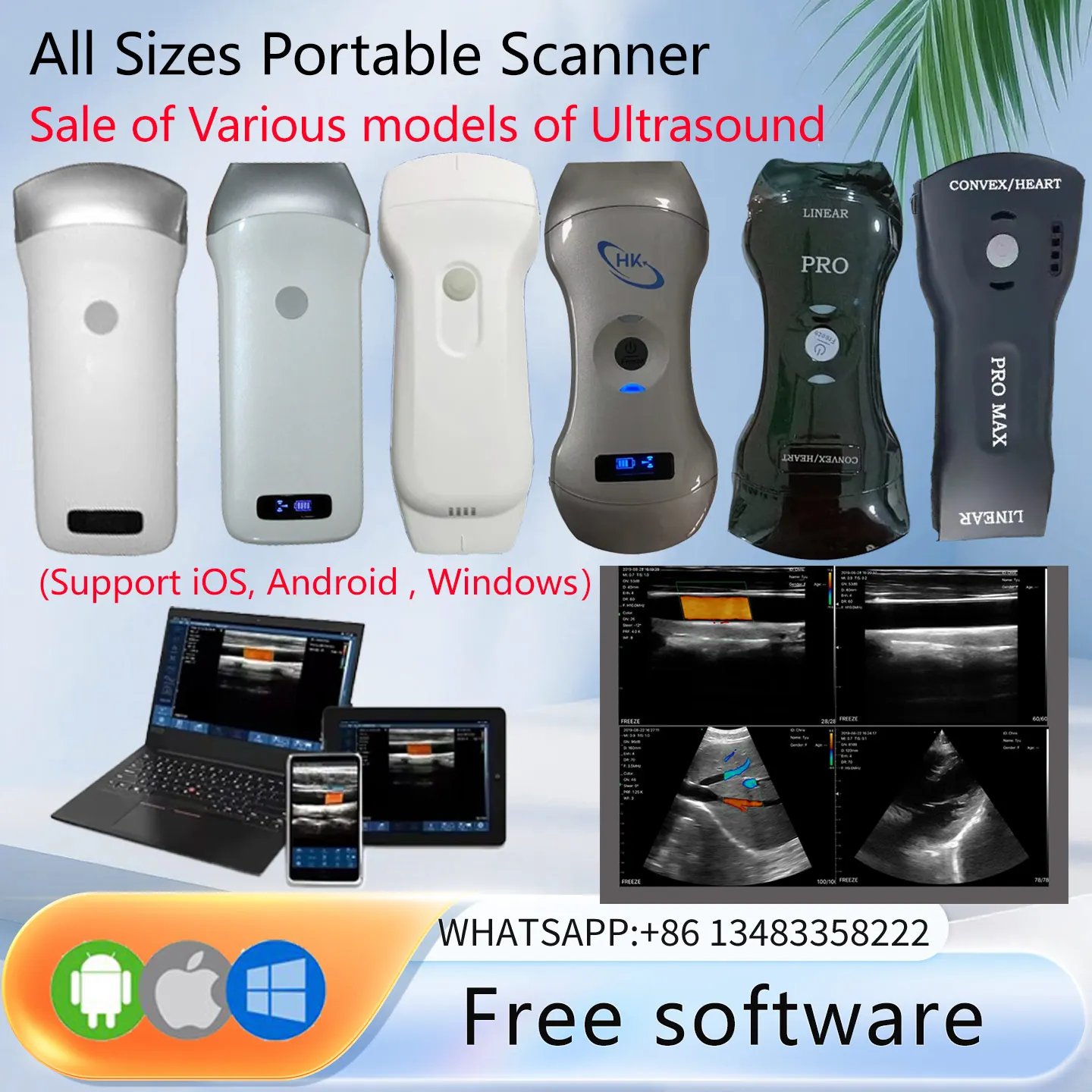 Sonostar Brand Factory Portable Wireless Ultrasound Probe Scanner Portable Machine WIFI Ultrasound Scanner Machine Support OEM
