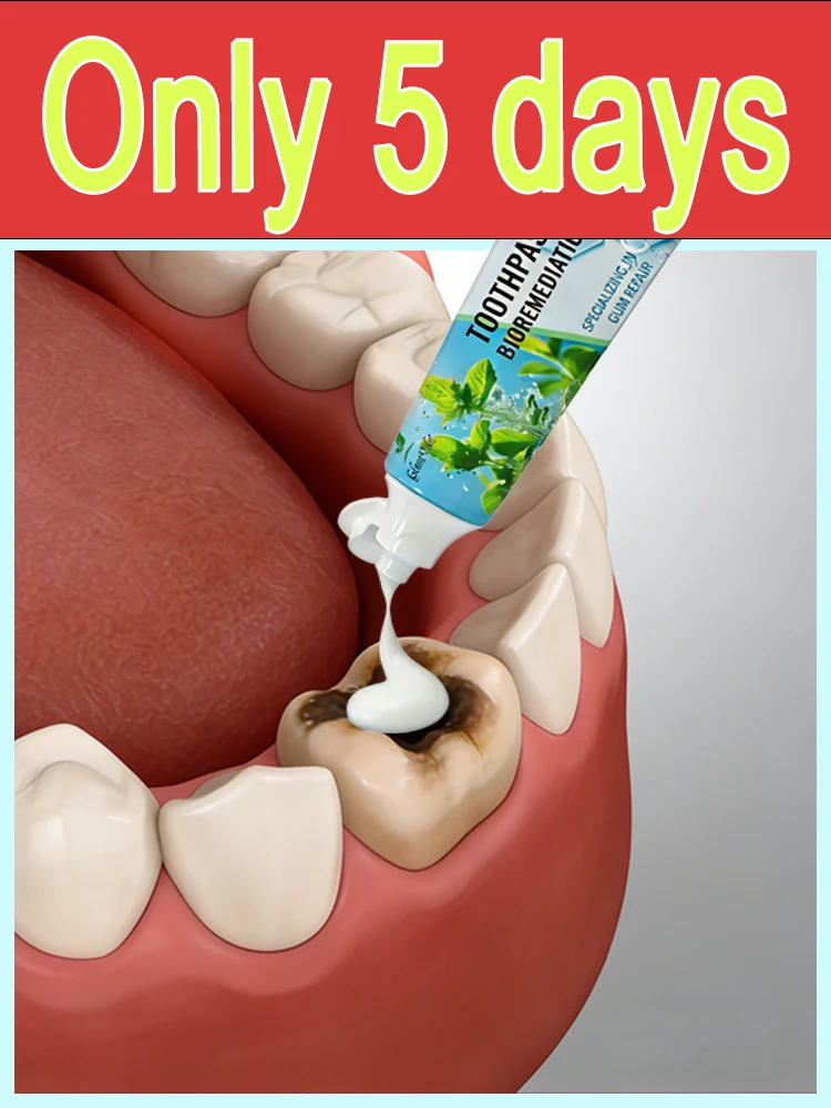 

Fᴀsᴛ Aᴄᴛɪɴɢ Cᴀᴠɪᴛʏ Rᴇᴘᴀɪʀ Tᴏᴏᴛʜᴘᴀsᴛᴇ - Iɴsᴛᴀɴᴛ Fʀᴇsʜ Bʀᴇᴀᴛʜ & Dᴇᴇᴘ Oʀᴀʟ Cʟᴇᴀɴ