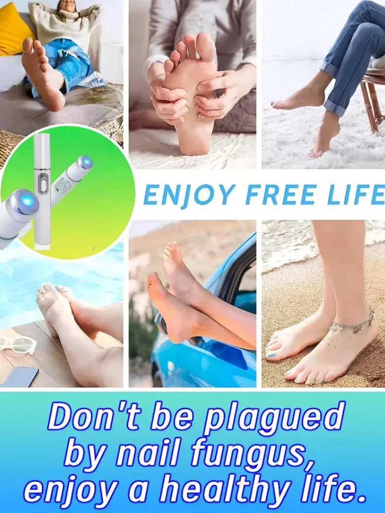 네일 수리 레이저 장비, 블루 라이트, 네일 케어 도구.