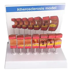 Artery Anatomical Model Anatomical Vessel Atherosclerosis Thrombus Vascular Model Human Artery Anatomy Model