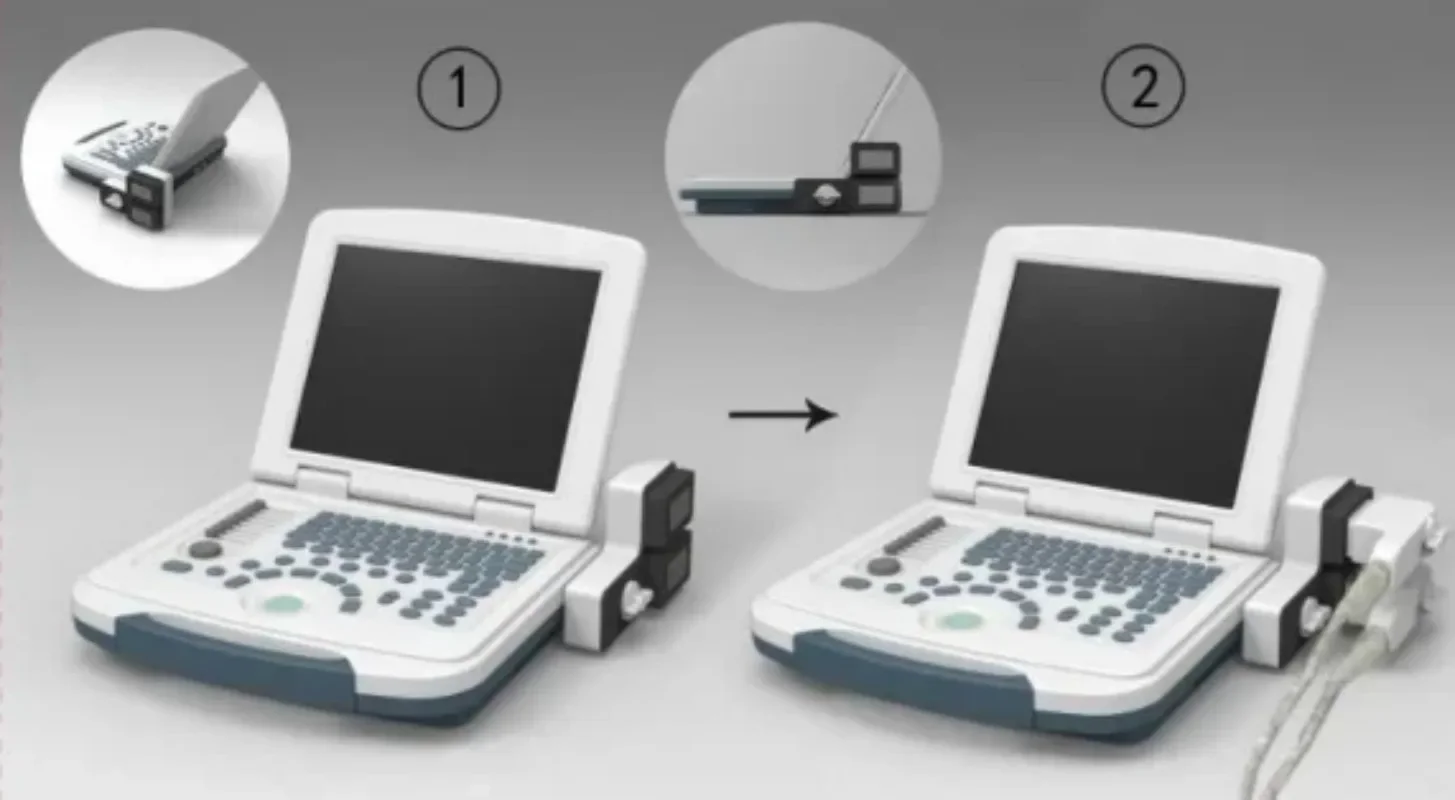 b/w ultrasound machine digital  for obstetrics and gynaecology