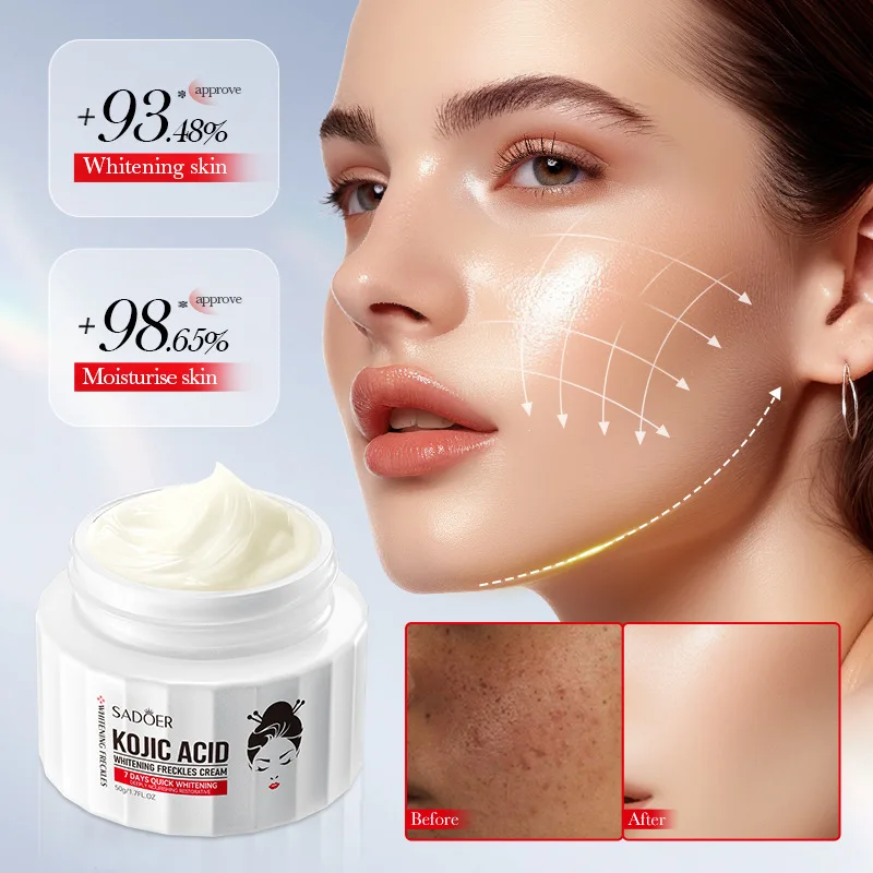 Crema de Ácido Kójico para eliminar pigmento, melanina, blanqueamiento, elimina manchas oscuras, nutritiva, ilumina, hidratante, cuidado de la piel, crema facial