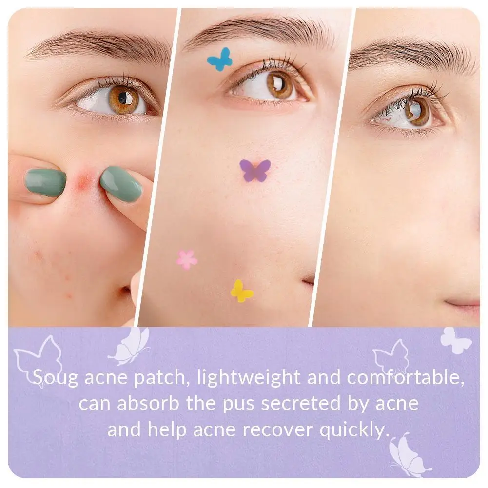 120PCs Butterfly Shape Acne Pimple Patch Stickers Blemish Spot Concealer Cover 0.1mm Acne Treatment Pimple Remover Skin Care