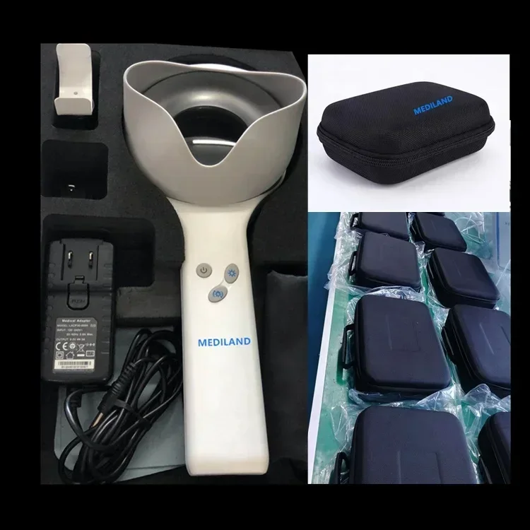 NEW Portable Woods Lamp ML-409 Medical Grade Microscope Dermatoscope With White LED Light Rechargeable Hair Analyzer CE