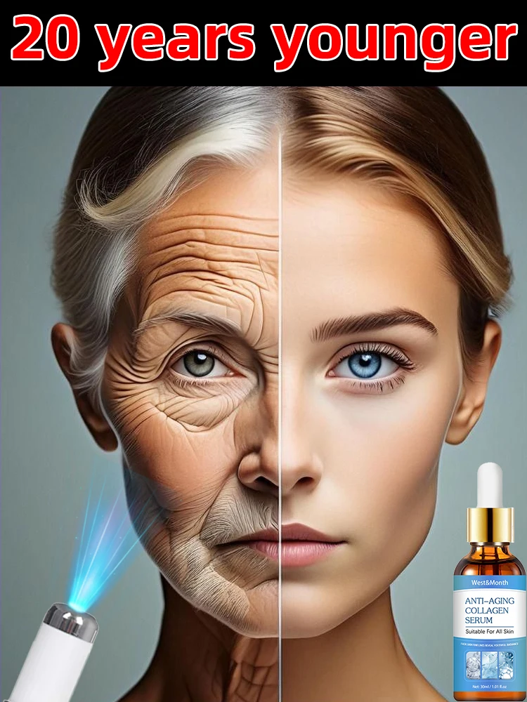 

20 years younger Erase Wrinkles in Just 7 Days
