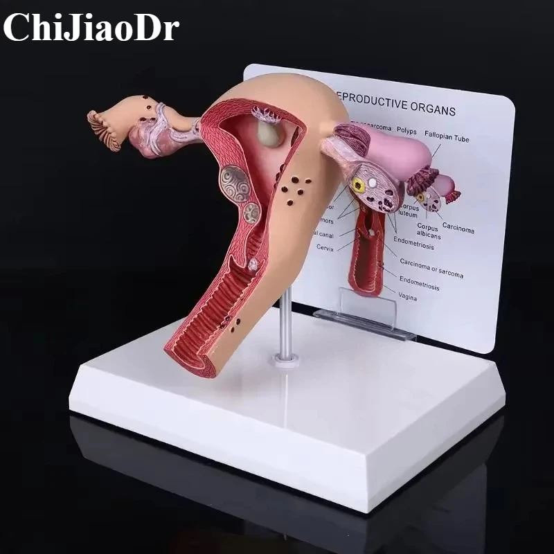 

Медицинские травмы, биология, обучающая модель реквизита, женская патология человека, модель матки и яичника, анатомия, патология заболеваний