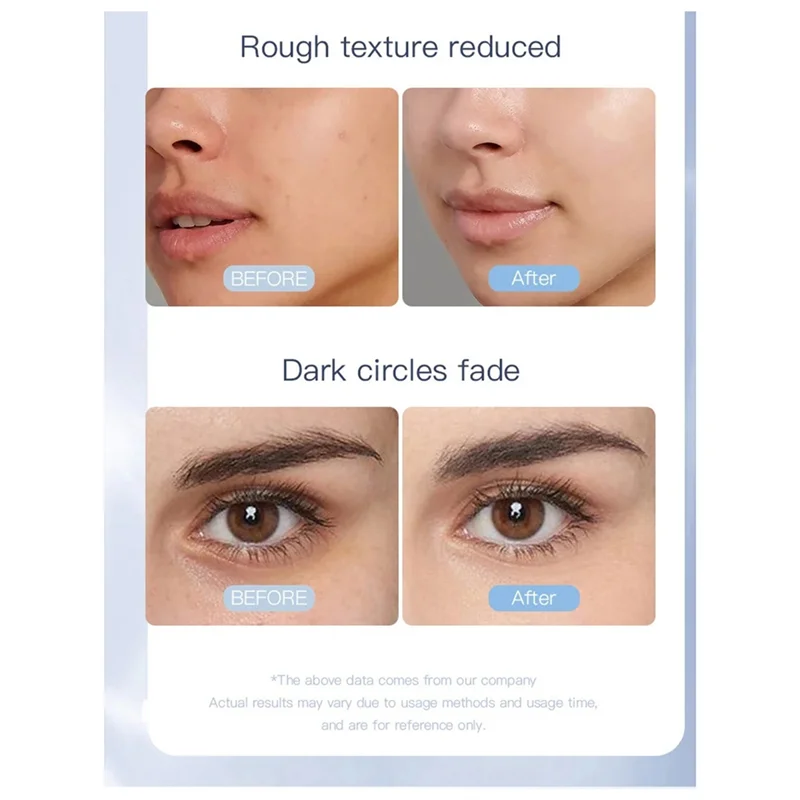 ลูกกลิ้งยกกระชับใบหน้าไฟฟ้าเครื่องนวด EMS Microcurrent Sonic Vibration Facial Lifting Skin Tighten Massage Beauty