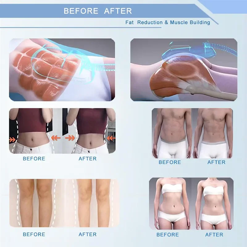 

Newest 6500w Upgraded System RF Fat Burning Slimming Weight Burn Fat Full Removal Body Slimming Body Muscle Training Machine