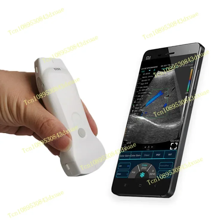 

Портативное ветеринарное ультразвуковое оборудование для коров, лошадей, коз, свиней, беременности, 4d, ультразвуковой сканер, машина для эхографа, электрическая CE