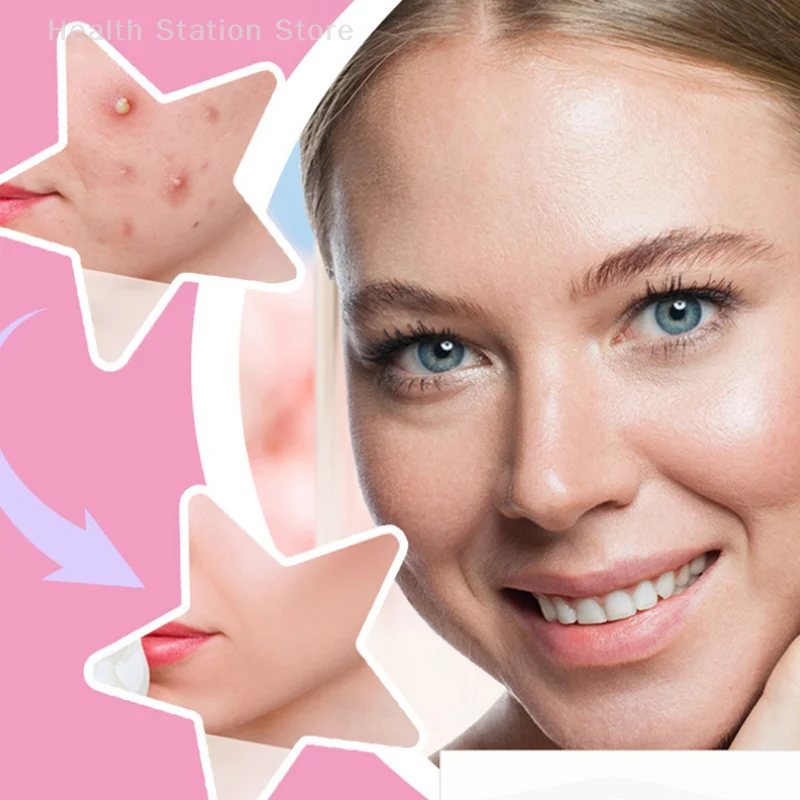 200 PCS สีสันน่ารักรูปดาวสิวสติกเกอร์ที่มองไม่เห็นสิวกําจัดสิว Patch Skin Care