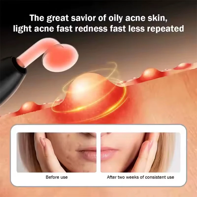 Dispositivo di bellezza per bacchetta facciale ad alta frequenza ringiovanimento ricaricabile portatile 7 in 1 per uso wireless