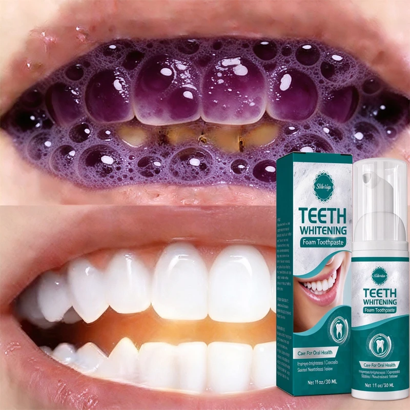 2026 Best selling Whitening Toothpaste: Say Goodbye to Yellow Teeth, Oral Hygiene Cleaning, and Teeth Care Tool