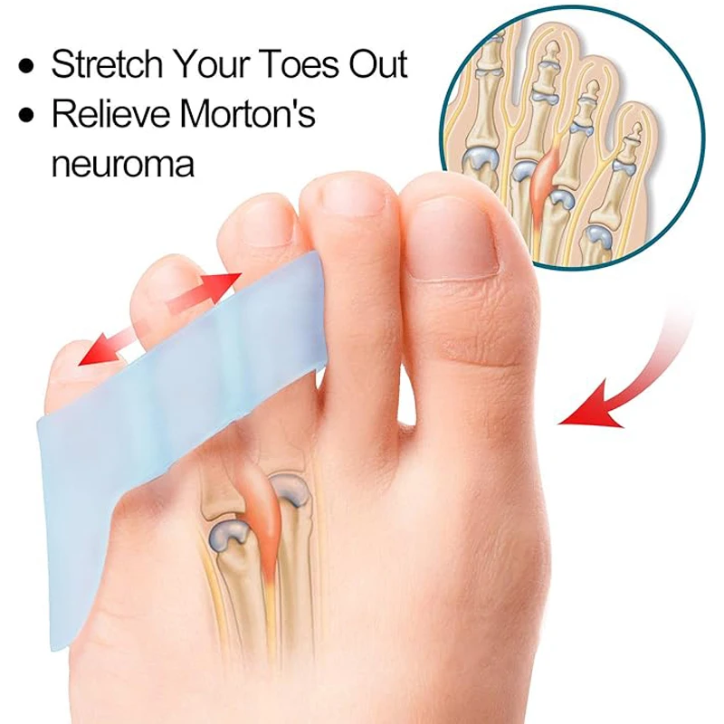 2 шт., разделитель для пальцев ног Morton's Neuroma