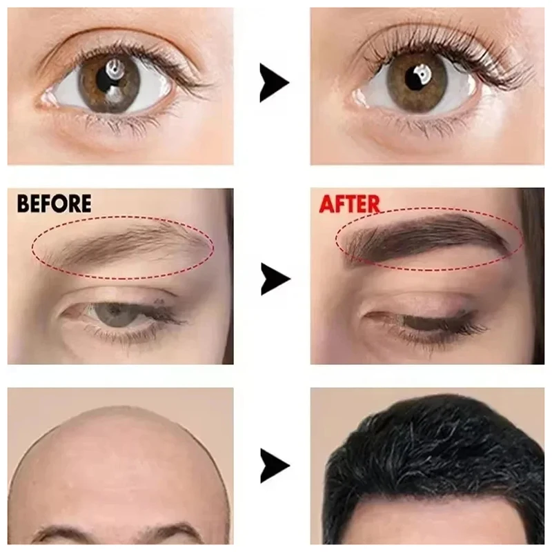 Fast Eyebrow Growth Serum Eyelash Hair Growth Prevent Baldness Fuller Thicker Lengthening Eyebrow Makeup Anti Hairs Loss Product