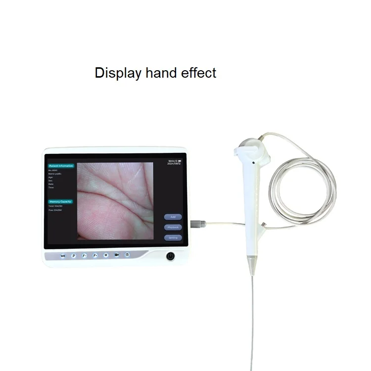 Professional Supply Hot Sales Flexible Veterinary Endoscope Veterinary Bronchoscope System