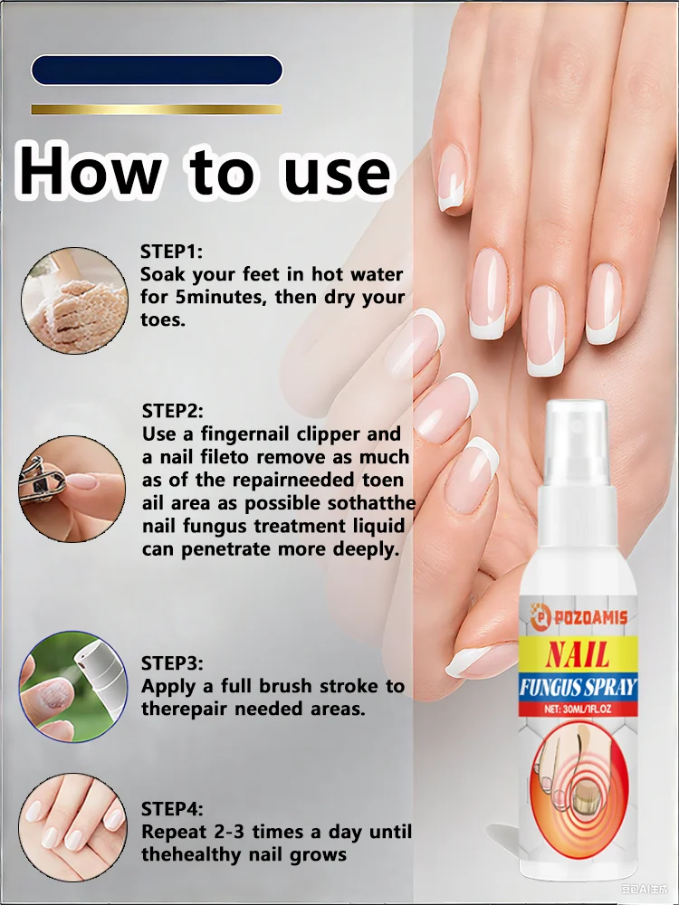 Spray antimicótico para uñas: limpia las uñas dañadas y descoloridas, fácil de usar.