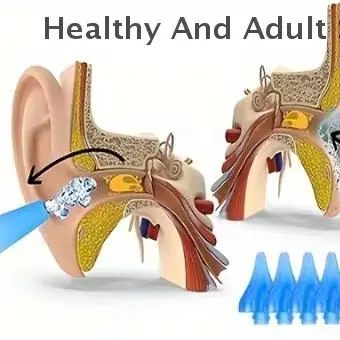 

7/9pcs Earwax Removal Kit Travel-Friendly Ear Cleaning Syringe Set Gentle Ear Cleaning Earball Tool