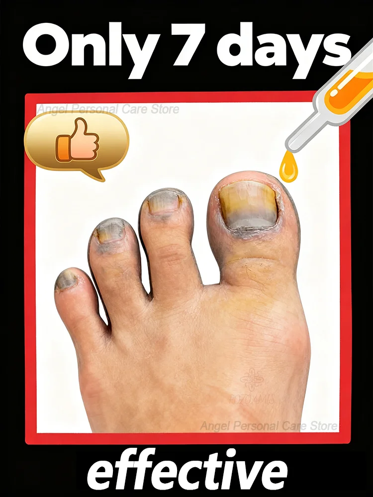 부드럽고 섬세하며, 사용하기 쉽고, 뛰어난 세정 효과를 가지고 있습니다.