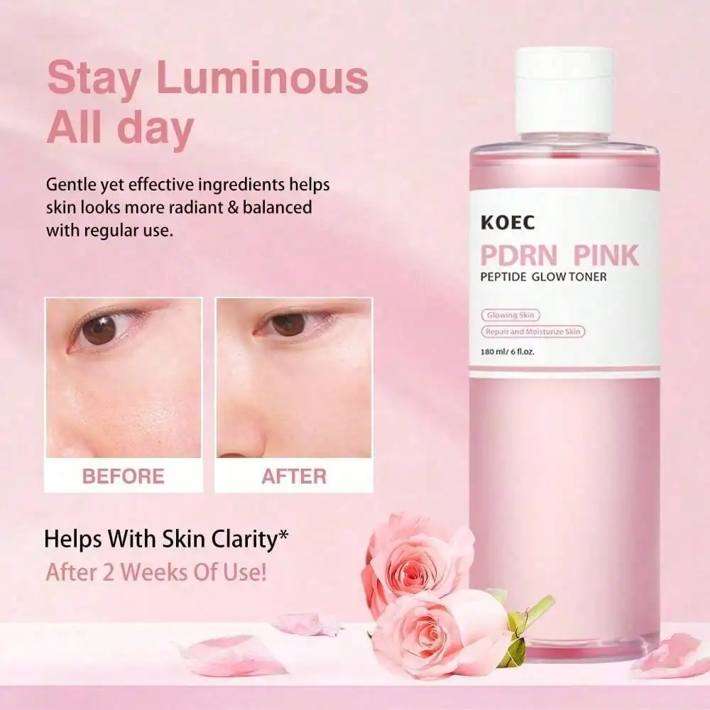 PDRN Pink Niacinamide Milk Toner, Gentle Skin Comforting Facial Toner, Infused with Salmon DNA, PDRN and Ceramide, Helps Improve Skin Redness and Discomfort, Mild Daily Skin Care for Sensitive Skin, 150ml