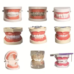 Multiple Types Dental Model Teeth Dental Teaching Models Study Orthodontic Removable Teeth Implant Models Dentist Material