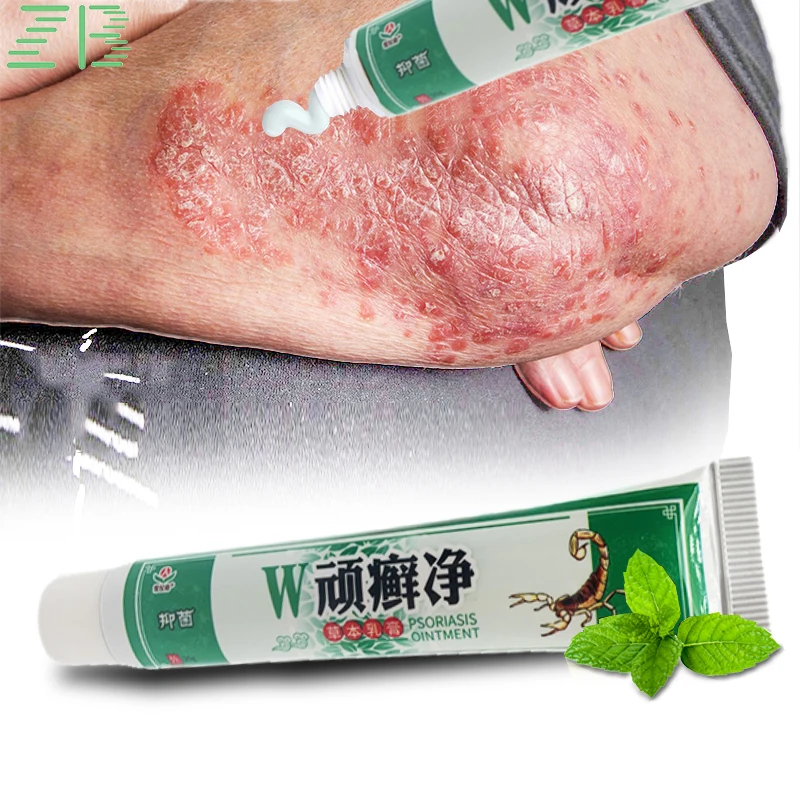 

15g Caoshifu Eczema Ointment Treatment Psoriasis Pruritus Dermatitis Eczematoid Cream Anti-Itch Chinese Herb Medical Skin Care