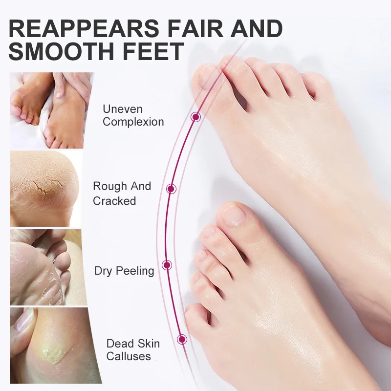 RtopR Peeling Foot Mask Exfoliating Dead Skin Improve Dry Cracked Foot Skin Repair Hydrate Pedicure Moisturizing Foot Care