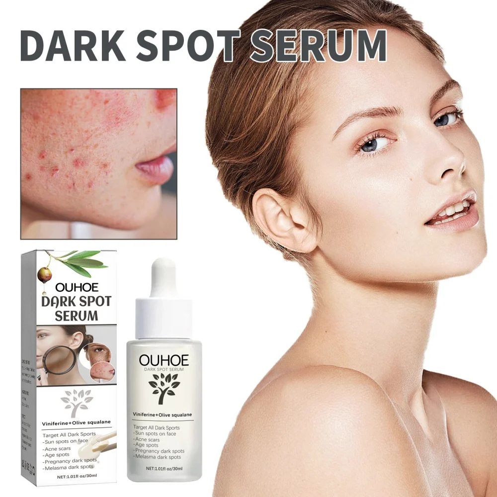 

Facial oil temperature and hydration to lighten blemishes and acne scars Treatment for sensitive and dry skin Care