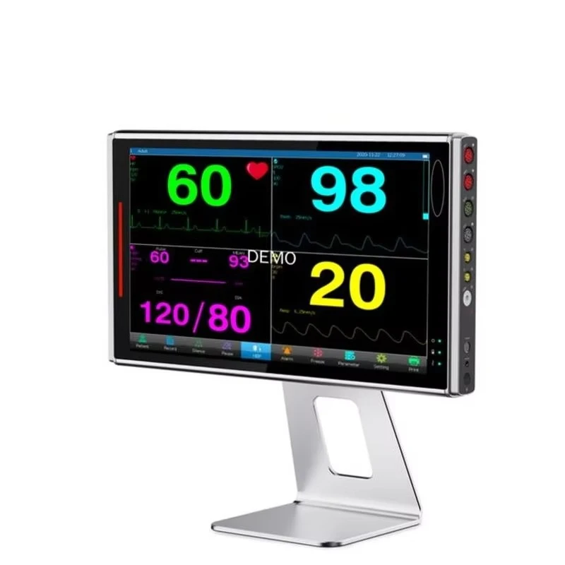 

Недорогие диагностические инструменты Портативные ветеринарные мониторы пациентов Оборудование для жизненно важных знаков