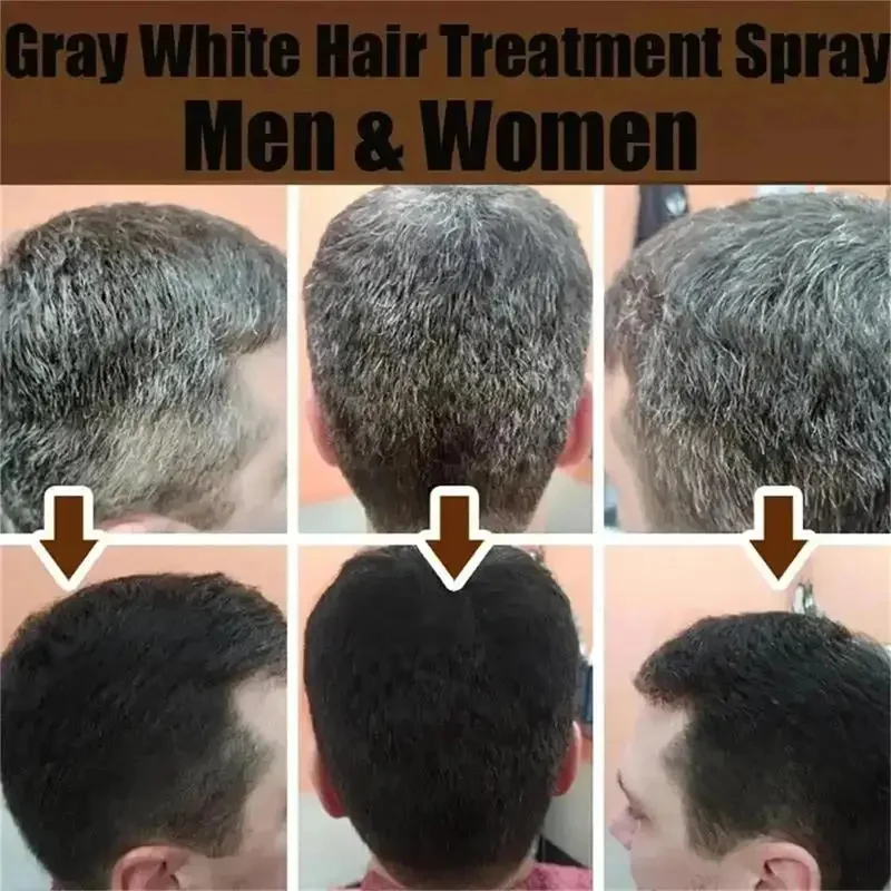 Gray White Hair Treatment Serum Soap Fast White To Black Repair Nourish Beard Hair Roots Shampoo Men Women Beauty Health Care