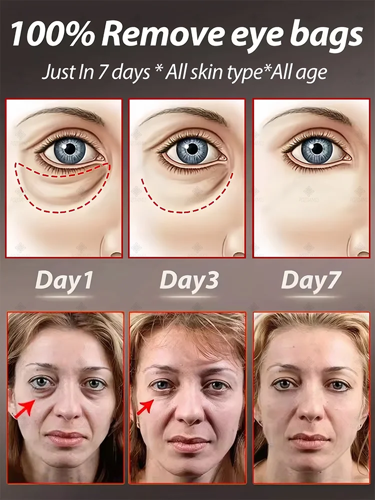 The best products of 2025,ᴵⁿˢᵗᵃⁿᵗˡʸ ʳᵉᵐᵒᵛᵉ ᵉʸᵉ ᵇᵃᵍˢ⸴ ʳᵉᵈᵘᶜᵉ ᶠⁱⁿᵉ ˡⁱⁿᵉˢ⸴ ᵗⁱᵍʰᵗᵉⁿ ˢᵏⁱⁿ⸴ ᶠⁱᵍʰᵗ ᵈᵃʳᵏ ᶜⁱʳᶜˡᵉˢ⸴ ᵃⁿᵈ ᵇʳⁱᵍʰᵗᵉⁿ ᵉʸᵉˢ