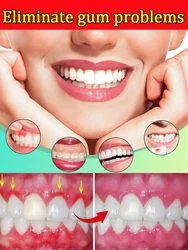 Suero para eliminar las manchas de los dientes, reparación rápida de las cavidades, gota de Caries, alivia la hinchazón Gingival, higiene Periodontal, cuidado bucal