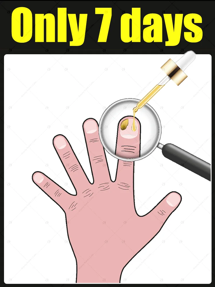 

2025 Hot Sales Multi-functional Nail Repair, Nail Solutions for Discolored and Damaged Nails