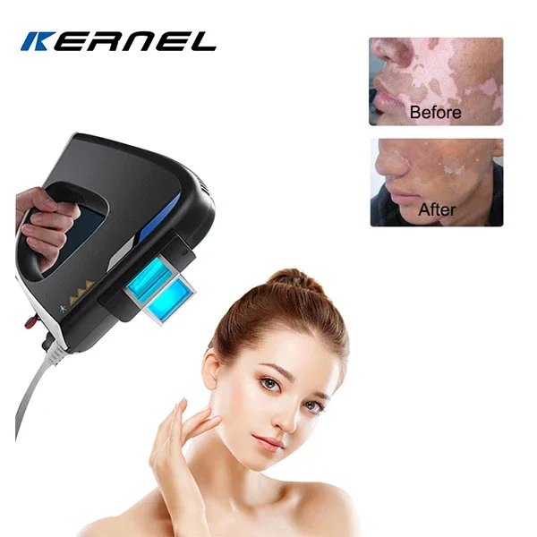 Kernel KN-5000C Portable Medical Equipment High Intensity eczema treatment device 308nm excimer  vitiligo treatment