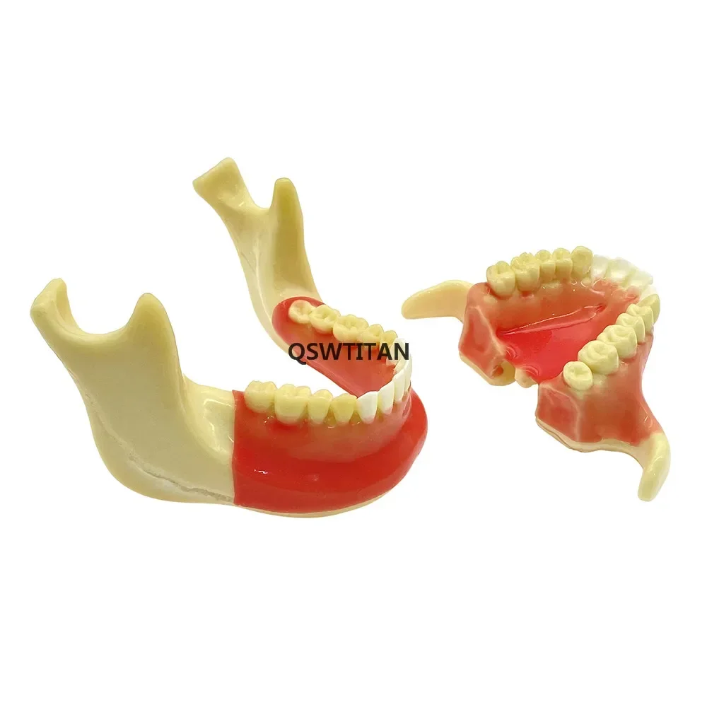 Ortho Implant Model Pathological Demonstration Ortodoncia Teeth Model Dental Study Model Teaching  for Student