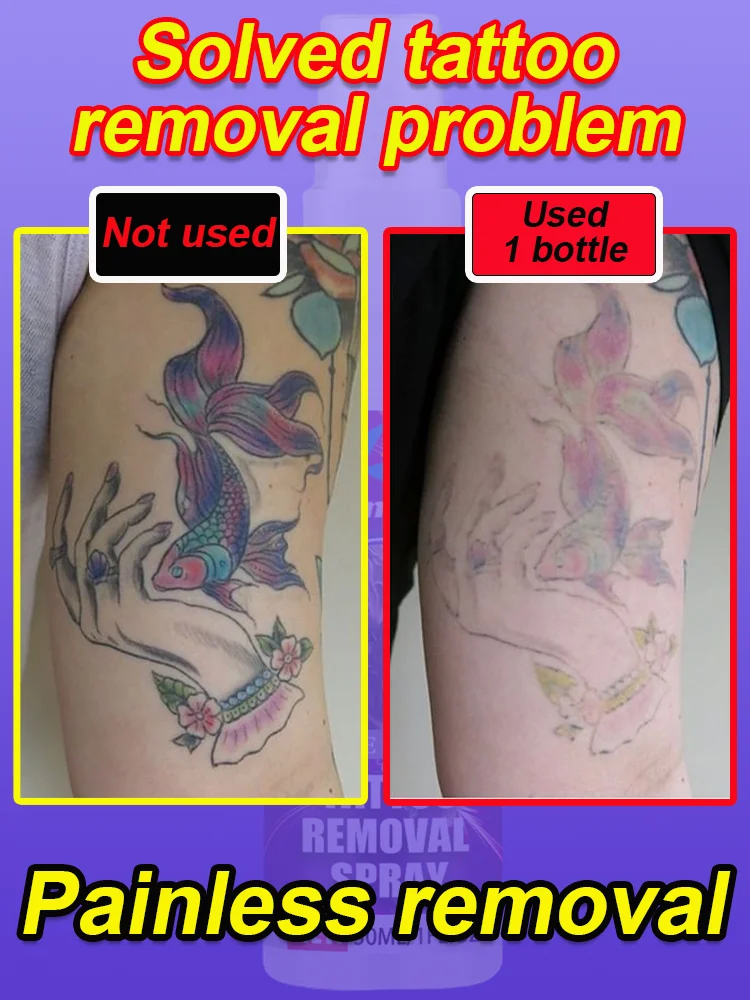 

Fast tattoo removal, natural, painless, depigmentation, clean