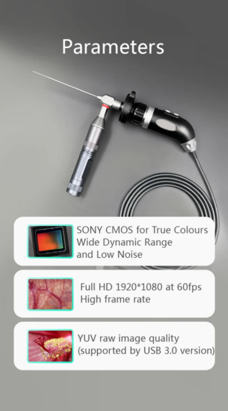 SY-P031H4  Medical ENT Endoscopy USB  Portable Endoscope