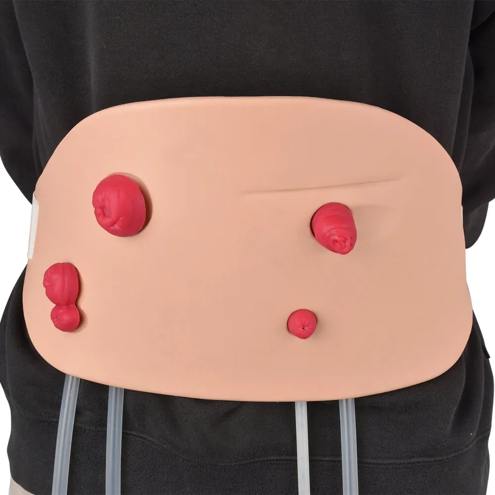 Wearable Ostomy Care Trainer Model for Teaching Demonstration
