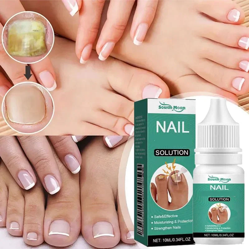 Óleo Essencial Herbáceo para Unhas, Unhas