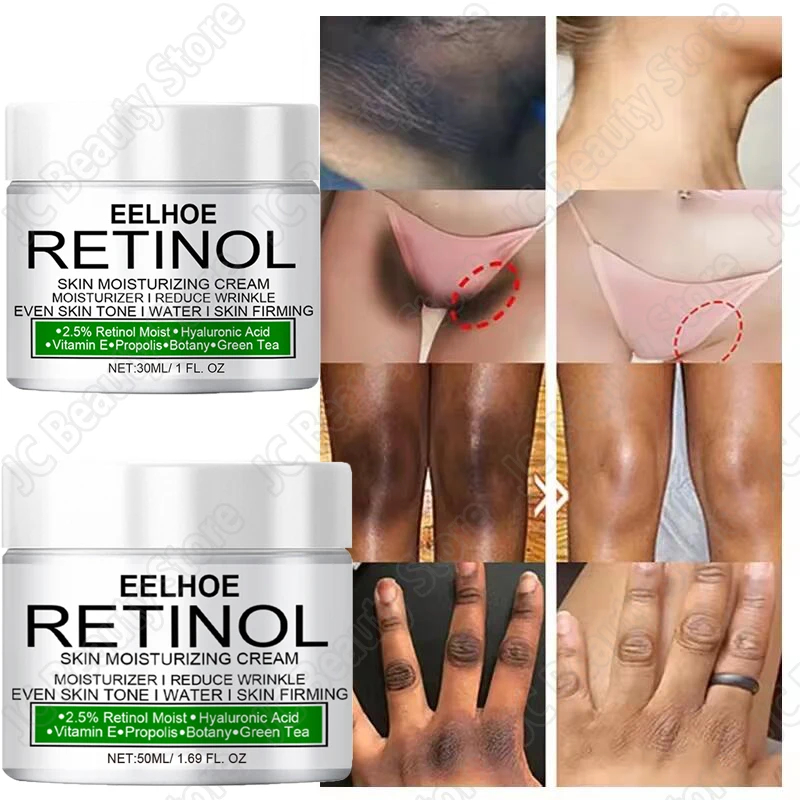 

Inner Thigh Brighten Cream Intimate Private Parts Knuckles Bleaching Butt Knee Lightening Lotion Remove Melanin Body Skin Care